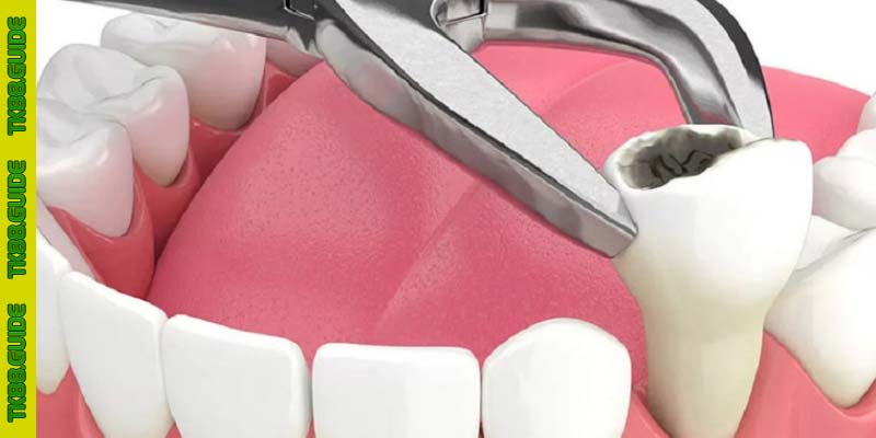 Giải Mã Giấc Mơ Thấy Bị Nhổ Răng: Điềm Báo Hay Lời Gợi Ý Số Đề? 3 Giải Mã Giấc Mơ Thấy Bị Nhổ Răng